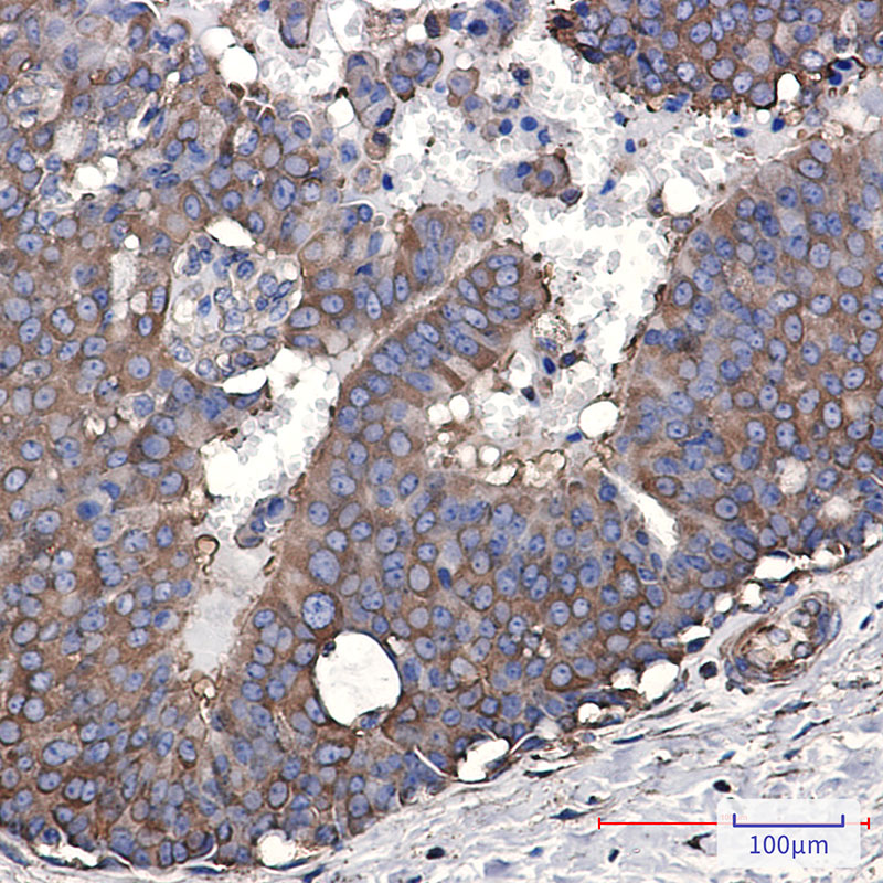 Elongation factor 2 Rabbit mAb
